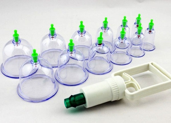 Bán buôn bộ giác hơi không dùng lửa