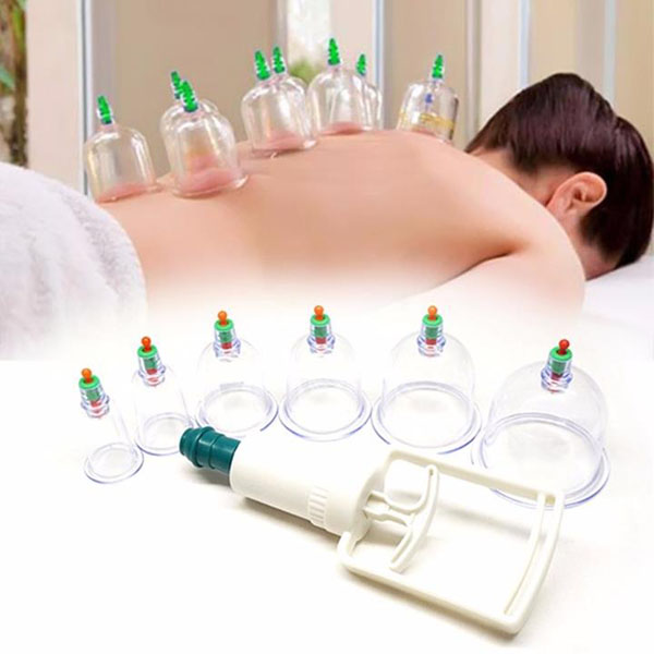 Bán buôn bộ giác hơi không dùng lửa 12 ống