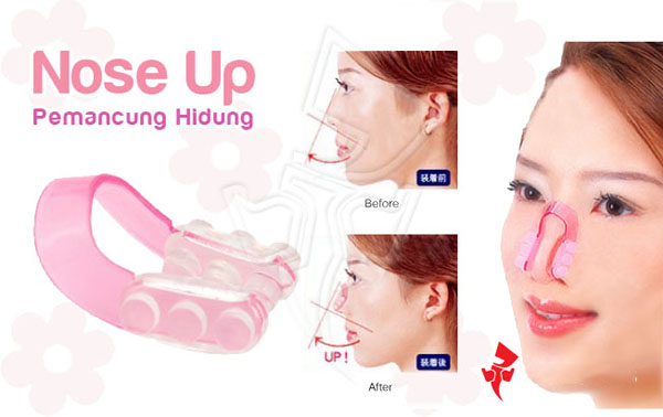 Bán sỉ dụng cụ nâng mũi Nose up